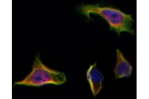 ABIN6259190 and ABIN6275696 staining Hela by IF/ICC.