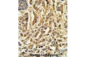 Immunohistochemistry (IHC) image for anti-Cytochrome P450, Family 21, Subfamily A, Polypeptide 2 (CYP21A2) antibody (ABIN3003552)