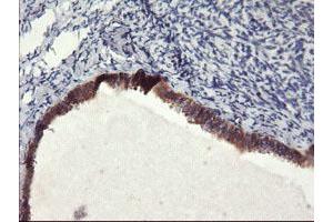 Immunohistochemical staining of paraffin-embedded Human Ovary tissue using anti-FBXO21 mouse monoclonal antibody. (FBXO21 Antikörper)