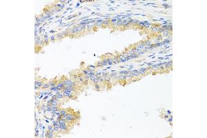 Immunohistochemistry of paraffin-embedded human prostate using ApoE antibody (ABIN5975768) at dilution of 1/100 (40x lens). (APOE Antikörper)