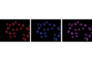 Immunofluorescence Microscopy of anti-Pol II S2p antibody Immunofluorescence Microscopy results of Mouse anti-Pol II S2p antibody. (POLR2A/RPB1 Antikörper  (pSer2))