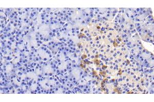 Detection of INSR in Human Pancreas Tissue using Polyclonal Antibody to Insulin Receptor (INSR) (Insulin Receptor Antikörper  (AA 1024-1298))