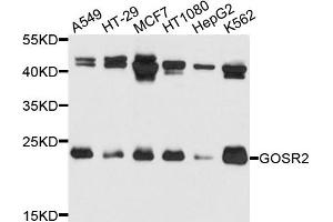 Western blot analysis of extracts of various cells, using GOSR2 antibody. (GOSR2 Antikörper)