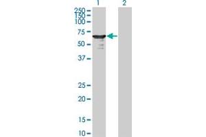 L3MBTL4 Antikörper  (AA 1-534)