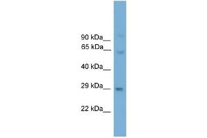 WB Suggested Anti-Prrx2 Antibody Titration:  0. (PRRX2 Antikörper  (N-Term))