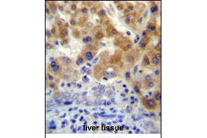 NT5C3L Antibody (N-term) (ABIN657206 and ABIN2846319) immunohistochemistry analysis in formalin fixed and paraffin embedded human liver tissue followed by peroxidase conjugation of the secondary antibody and DAB staining. (NT5C3L Antikörper  (N-Term))
