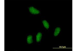 Immunofluorescence of purified MaxPab antibody to KCTD15 on HeLa cell. (KCTD15 Antikörper  (AA 1-234))