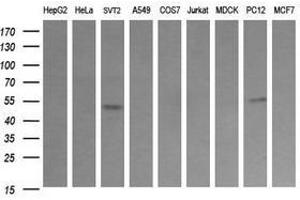 Image no. 1 for anti-Tripartite Motif Containing 38 (TRIM38) (AA 1-265) antibody (ABIN1490689)
