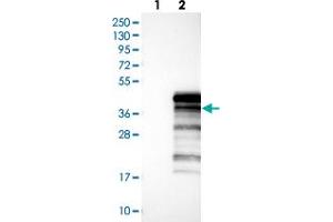 Western blot analysis of Lane 1: Negative control (vector only transfected HEK293T lysate), Lane 2: Over-expression Lysate (Co-expressed with a C-terminal myc-DDK tag (~3. (UBXN10 Antikörper)