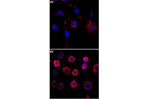 Immunocytochemistry staining of serum-starved A431 cells (A) and serum-starved A431 cells treated with EGF (B) using Phosphotyrosine monoclonal antibody, clone RM111  (Red) at 1:500 dilution. (Phosphotyrosine Antikörper)