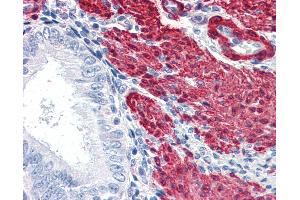 Anti-TAGLN / SM22 antibody IHC of human uterus. (Transgelin Antikörper  (AA 190-201))