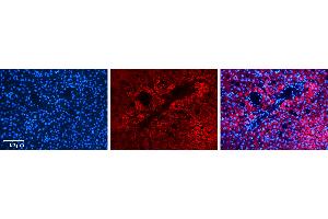 Rabbit Anti-CPT2 Antibody   Formalin Fixed Paraffin Embedded Tissue: Human Liver Tissue Observed Staining: Cytoplasm in hepatocytes Primary Antibody Concentration: N/A Other Working Concentrations: 1:600 Secondary Antibody: Donkey anti-Rabbit-Cy3 Secondary Antibody Concentration: 1:200 Magnification: 20X Exposure Time: 0. (CPT2 Antikörper  (N-Term))