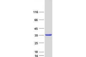 Western Blotting (WB) image for Thioredoxin Domain Containing 9 (TXNDC9) protein (Myc-DYKDDDDK Tag) (ABIN2734682)