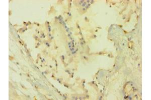 Immunohistochemistry of paraffin-embedded human prostate tissue using ABIN7167024 at dilution of 1:100 (AKT1 Antikörper  (AA 1-480))
