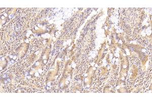 Immunohistochemistry (IHC) image for anti-Leukemia Inhibitory Factor (LIF) (AA 2-201) antibody (ABIN7425671)