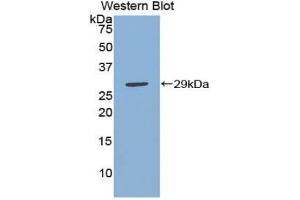 Western blot analysis of the recombinant protein. (IKbIP Antikörper  (AA 78-301))