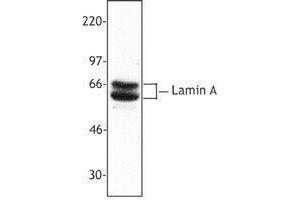 Western Blotting (WB) image for anti-Lamin A/C (LMNA) antibody (ABIN2666170) (Lamin A/C Antikörper)