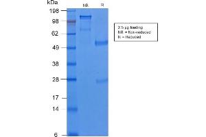 SDS-PAGE Analysis of Purified Cytokeratin 8 Rabbit Recombinant Monoclonal Antibody (KRT8/2174R). (Rekombinanter KRT8 Antikörper)