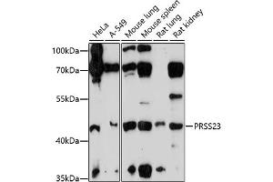 Western blot analysis of extracts of various cell lines, using PRSS23 antibody (ABIN7269582) at 1:1000 dilution. (PRSS23 Antikörper  (AA 101-220))