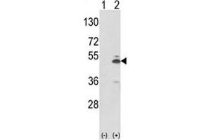 Western blot analysis of PKM2 antibody and 293 cell lysate (2 ug/lane) either nontransfected (Lane 1) or transiently transfected with the PKM2 gene (2). (PKM2 Antikörper  (AA 116-145))