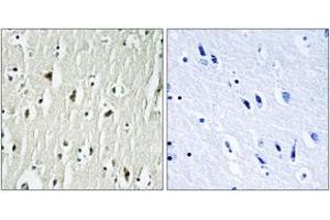 Immunohistochemistry analysis of paraffin-embedded human brain tissue, using CSK (Ab-364) Antibody. (CSK Antikörper  (AA 330-379))