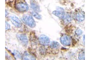 Immunohistochemistry (IHC) image for anti-Transforming Growth Factor, beta 1 (TGFB1) antibody (ABIN181152) (TGFB1 Antikörper)