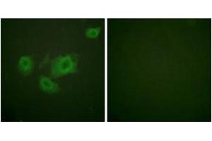 Immunofluorescence analysis of HuvEc cells, using Kir6. (KCNJ11 Antikörper  (pThr224))