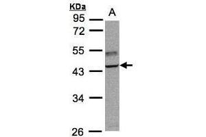WB Image Sample(30 ug whole cell lysate) A:Raji , 10% SDS PAGE antibody diluted at 1:3000 (TRAF1 Antikörper)