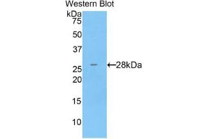 Western blot analysis of the recombinant protein. (CTSC Antikörper  (AA 231-463))