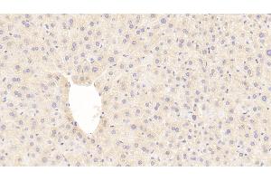 Detection of GLb in Mouse Liver Tissue using Polyclonal Antibody to Galactosidase Beta (GLb)
