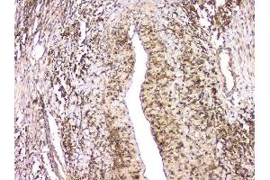 IHC analysis of HECTD3 using anti-HECTD3 antibody (ABIN6719595). (HECTD3 Antikörper)