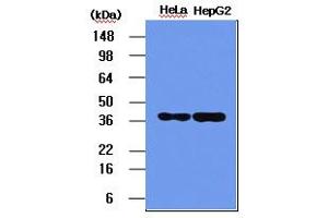 Western blot analysis: The HeLa and HepG2 cell lysates (5ug) were resolved by SDS-PAGE, transferred to PVDF membrane and probed with anti-human NPM (1:1000). (NPM1 Antikörper)