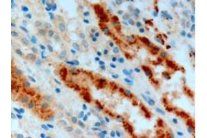 ABIN185477 (3µg/ml) staining of paraffin embedded Human Kidney. (Adenosine A2b Receptor Antikörper  (C-Term))