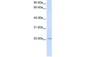 Western Blotting (WB) image for anti-Transmembrane Protein 9 (TMEM9) antibody (ABIN2459084) (TMEM9 Antikörper)