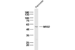 Mouse pancreas lysates probed with MRS2 Polyclonal Antibody, Unconjugated  at 1:300 dilution and 4˚C overnight incubation. (MRS2 Antikörper  (AA 201-300))