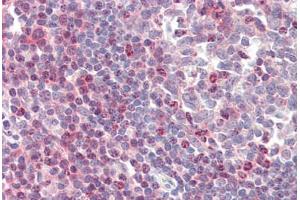 Human Tonsil (formalin-fixed, paraffin-embedded) stained with ZAP70 antibody ABIN461961 at 20 ug/ml followed by biotinylated anti-mouse IgG secondary antibody ABIN481714, alkaline phosphatase-streptavidin and chromogen. (ZAP70 Antikörper)