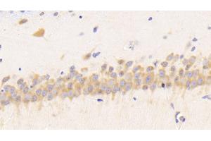 Detection of RETN in Rat Cerebrum Tissue using Polyclonal Antibody to Resistin (RETN) (Resistin Antikörper  (AA 45-114))