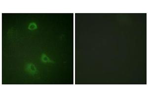 Immunofluorescence analysis of A549 cells, using NMDAR1 (Phospho-Ser890) antibody. (GRIN1/NMDAR1 Antikörper  (pSer890))