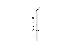 Anti-IGFBP-3- Antibody at 1:1000 dilution + human liver lysate Lysates/proteins at 20 μg per lane. (IGFBP3 Antikörper  (AA 162-189))