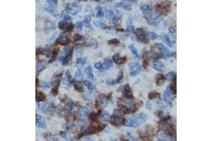 Immunohistochemical analysis of LCK staining in human lymph node formalin fixed paraffin embedded tissue section. (LCK Antikörper)