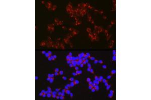 Immunofluorescence analysis of SH-SY5Y cells using  Rabbit pAb (ABIN6129958, ABIN6136993, ABIN6136994 and ABIN6222595) at dilution of 1:50 (40x lens). (APLP1 Antikörper  (AA 39-300))