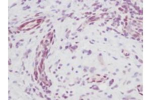 Image no. 5 for anti-Melanoma Inhibitory Activity (MIA) antibody (ABIN464851) (MIA Antikörper)