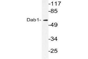 Western blot (WB) analyzes of Dab1 antibody in extracts from HeLa cells. (DAB1 Antikörper)