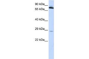WB Suggested Anti-TPK1 Antibody Titration: 0. (TPK1 Antikörper  (N-Term))