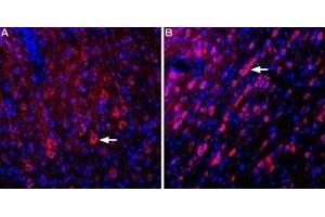 Expression of Glutamate receptor δ1 in rat cortex and medial septum - Immunohistochemical staining of perfusion-fixed frozen rat brain sections using Anti-GRID1 (extracellular) Antibody (ABIN7043235, ABIN7044374 and ABIN7044375), (1:400). (GRID1 Antikörper  (Extracellular, N-Term))