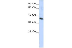 WB Suggested Anti-ST6GALNAC1 Antibody Titration:  0. (ST6GALNAC1 Antikörper  (Middle Region))