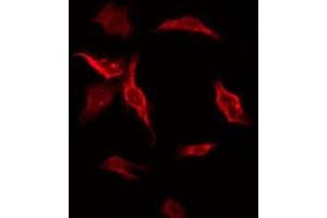 ABIN6272672 staining HT-29 by IF/ICC. (HTR3D Antikörper)
