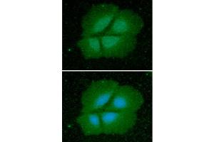 ICC/IF analysis of Cyclophilin B in Hep3B cells line, stained with DAPI (Blue) for nucleus staining and monoclonal anti-human Cyclophilin B antibody (1:100) with goat anti-mouse IgG-Alexa fluor 488 conjugate (Green). (PPIB Antikörper  (AA 26-216))