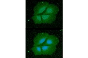 ICC/IF analysis of Cyclophilin B in Hep3B cells line, stained with DAPI (Blue) for nucleus staining and monoclonal anti-human Cyclophilin B antibody (1:100) with goat anti-mouse IgG-Alexa fluor 488 conjugate (Green). (PPIB Antikörper)