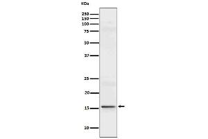 Western blot analysis of IL9 in Recombinant Human IL9 protein cell lysate.